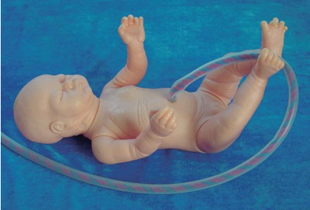 新生儿脐带护理模型