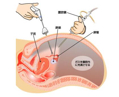 腹腔镜模拟训练器