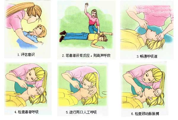心肺复苏(CPR)急救操作步骤