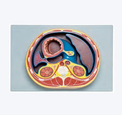 腹腔横断模型图