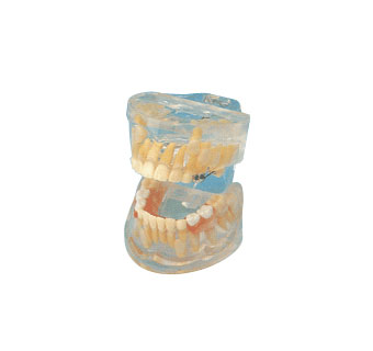 透明乳牙发育模型图