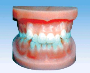 正畸牙齿模型图