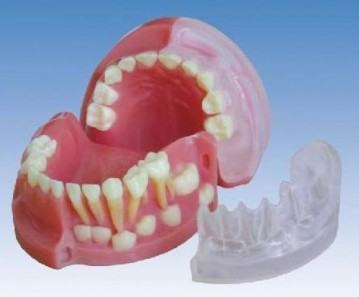 三岁乳恒牙交替解剖模型图