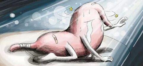 该如何对消化性溃疡患者进行护理